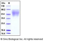 Sino Biological Mouse CD86 / B7-2 Protein (His Tag) 100ug, Quantity: Each