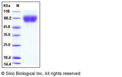 Sino Biological Mouse FGFR3 / CD333 Protein (His Tag) 100ug, Quantity: