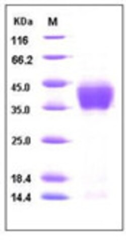 Sino Biological Mouse ASGPR1 / ASGR1 Protein (His Tag) 100ug, Quantity: