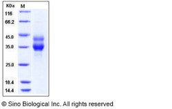 Sino Biological Recombinant Mouse 5'-nucleotidase/CD73/NT5E Protein (His
