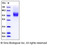 Sino Biological Recombinant Mouse CD64/FCGR1 Protein (His & AVI Tag), Biotinylated,