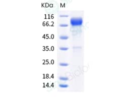 Sino Biological Recombinant Mouse IL-2R gamma/CD132 Protein (ECD, hFc Tag),
