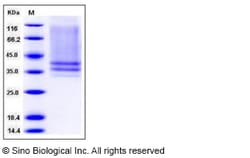 Sino Biological Recombinant Mouse IL-7R alpha/CD127 Protein (His Tag),