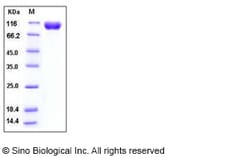 Sino Biological Recombinant Mouse IL-18Rα Protein (His & hFc Tag), Quantity: