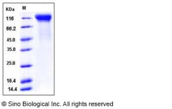 Sino Biological Recombinant Mouse IL-12 R beta 2/IL12RB2 Protein (His Tag),