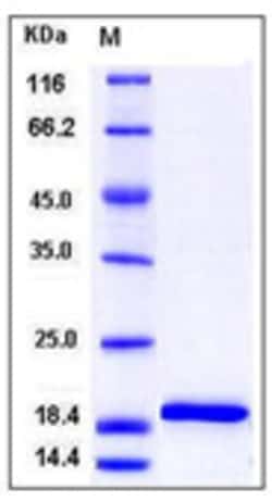Sino Biological Mouse IL-1 beta / IL1B Protein 100ug, Quantity: Each of
