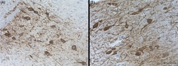 Biolegend Purified (azide-free) anti-Tyrosine Hydroxylase, Quantity: Each