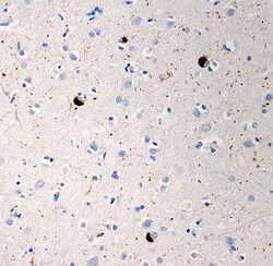 Biolegend Purified anti-α-Synuclein Phospho (Ser129), Quantity: Each of