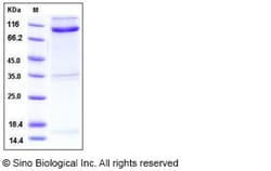 Sino Biological Recombinant Mouse Nogo Receptor/RTN4R Protein (His & hFc