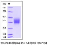 Sino Biological Recombinant Mouse Oncostatin M/OSM Protein (His Tag) 1,
