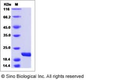 Sino Biological Recombinant Mouse IL-11 Protein, Quantity: Each of 1