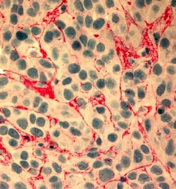 AdipoGen anti-Fibronectin (EDA), mAb (blocking) (IST-9) (preservative free),