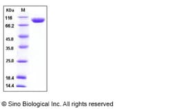 Sino Biological Mouse PIGR Protein (His Tag) 100ug, Quantity: Each of 1