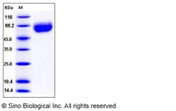 Sino Biological Recombinant Mouse AXL Protein (His Tag), HPLC-verified,