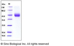 Sino Biological Protein Mouse TFPI 50ug, Quantity: Each of 1