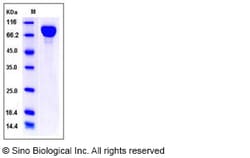 Sino Biological Recombinant Mouse gp130/IL6ST Protein (His Tag), HPLC-verified