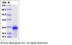 Sino Biological Recombinant Mouse IL-6 Protein, Quantity: Each of 1