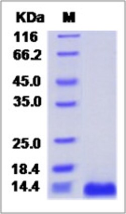 Sino Biological Mouse CXCL16 / SR-PSOX Protein (His Tag) 100ug, Quantity: