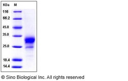 Sino Biological Recombinant Mouse TROY/TNFRSF19 Protein (His Tag), Quantity: