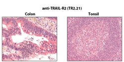 AdipoGen anti-TRAIL-R2 (human), mAb (TR2.21) (100 µg), Quantity: Each of