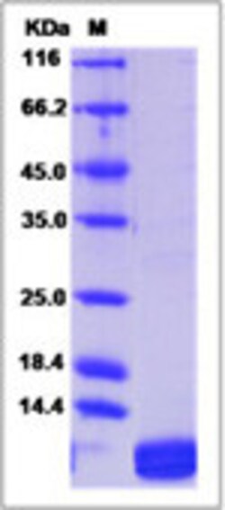 Sino Biological Mouse CXCL1 / MGSA / NAP-3 Protein 20ug, Quantity: Each