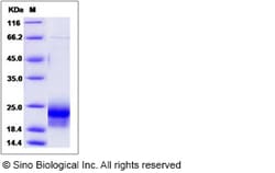 Sino Biological Recombinant Mouse VEGF-D Protein (His Tag) 500, Quantity: