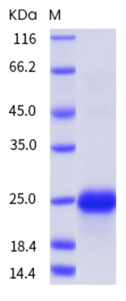 Sino Biological Mouse VEGFA / VEGF164 Protein 1mg, Quantity: Each of 1