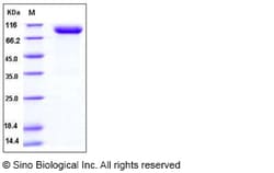 Sino Biological Mouse PLAUR / CD87 / uPAR Protein (His & Fc Tag) 100ug,