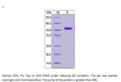 ACROBiosystems Recombinant Protein;Human CD5 Protein;HEK293;100UG;CD5,CD5,LEU1,LEU-1,