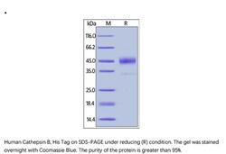 ACROBiosystems Recombinant Protein;Human Cathepsin B / CTSB Protein;HEK293;50UG;CTB,CTSB,CPSB,Cathepsin