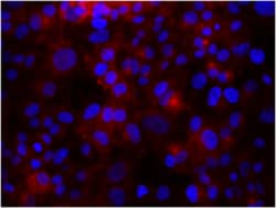 Biolegend Purified anti-human CD61, Quantity: Each of 1