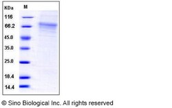 Sino Biological Mouse GFRA2 / GFRα2 / GDNFRB Protein (His Tag) 100ug, Quantity:
