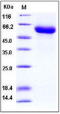 Sino Biological Mouse GFRA1 / GFR alpha-1 Protein (His Tag) 100ug, Quantity:
