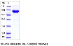 Sino Biological Recombinant Mouse ACVR2B Protein (His & hFc Tag), HPLC-verified,