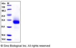 Sino Biological Mouse FGF18 / FGF-18 Protein (His Tag) 50ug, Quantity: