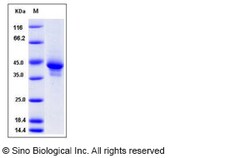 Sino Biological Recombinant Mouse I-309/CCL1 Protein (hFc Tag), Quantity: