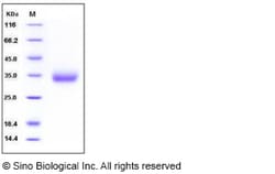 Sino Biological Recombinant Mouse VSIG4 Protein (His Tag), HPLC-verified