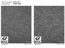ATCC CCRF-CEM LEUKEMIA; HUMAN, Quantity: Each of 1