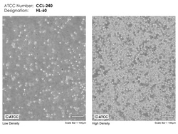 ATCC HL-60, Promyelocytic Leukemia, Frozen, Quantity: Each of 1