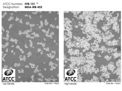 ATCC MDA-MB-453 BREAST CARCINOMA, Quantity: Each of 1
