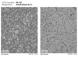 ATCC Jurkat, Clone E6-1, Acute T Cell Leukemia, Frozen, Quantity: Each