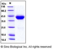 Sino Biological Recombinant Mouse CD38 Protein (His Tag), HPLC-verified,
