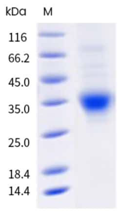 Sino Biological Mouse CD38 Protein 100ug (Sino Biological), Quantity: Each