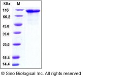 Sino Biological Mouse FGFR4 / CD334 Protein (His & Fc Tag) 100ug, Quantity: