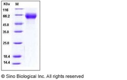 Sino Biological Recombinant Mouse FGFR4 Protein (His Tag), HPLC-verified,