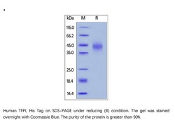 ACROBiosystems ACROBiosystems Human TFPI Protein, His Tag, Quantity: Each