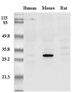 AdipoGen anti-Adiponectin (mouse), mAb (MADI 1147) (50 µg), Quantity: Each