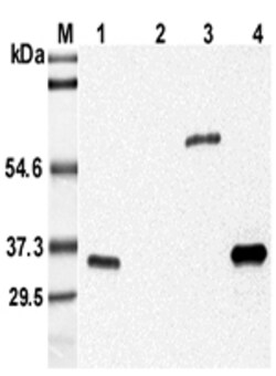 AdipoGen anti-Adiponectin (mouse), mAb (MADI 04) (100 µg), Quantity: Each