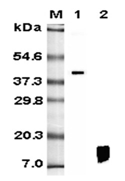 AdipoGen anti-RELM-beta (human), mAb (HRB 149) (100 µg), Quantity: Each