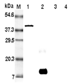 AdipoGen anti-Resistin (rat), mAb (RRES 07) (100 µg), Quantity: Each of